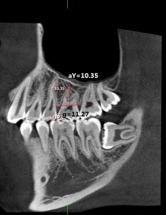 Cirugía maxilofacial León, Gto. 