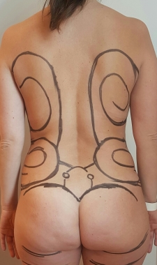 Pre op Lipoescultura