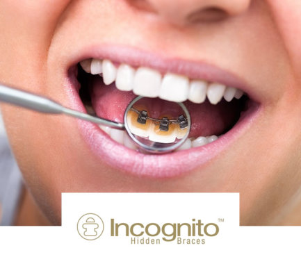Brace Clinic - Orthodontist - Cosmetic Dentistry - Dentist - Dental Clinic The Park Brace Clinic - Private Orthodontist Derby - Cosmetic Dentistry From our dental brace clinic in Pride Park, Derby we offer a wide  range of brace systems and treatments including Invisalign, Incognito lingual braces, Six month smiles, Damon Brace, standard fixed brace 