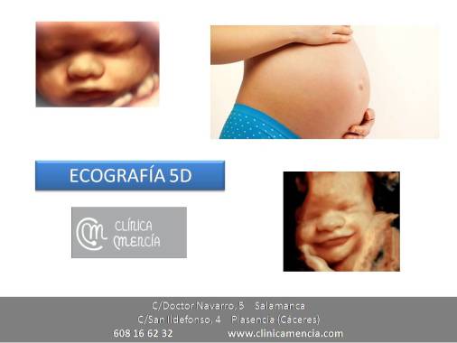 Ecografía 5D