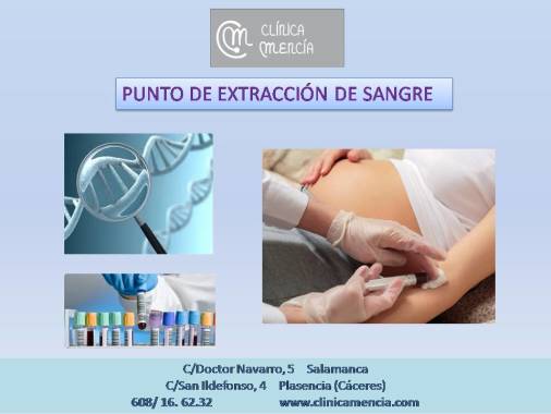 Punto de Extracción para analìticas