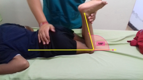 evaluación y tratamiento a pacientes neurologicos 