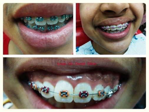 Smile On Dental Clinic