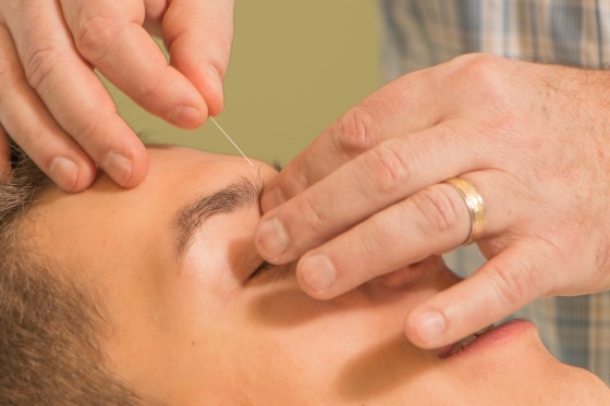 Balance Method Acupuncture provides immediate results.
