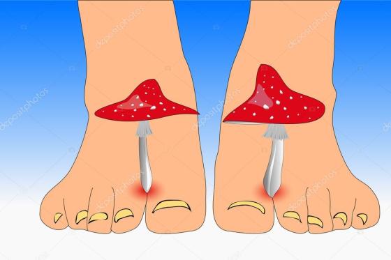 HONGOS EN LOS PIES 