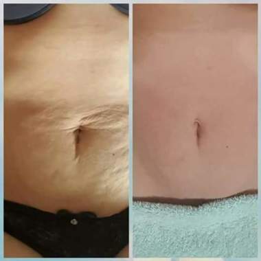 Mb Massoterapia