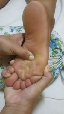 Reflexologia Podal