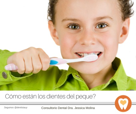 Es muy importante que los padres estén atentos a la higiene bucal de sus hijos. El desarrollo de caries dentales puede implicar pérdida prematura de dientes y problemas en la mordida de los chicos. #dentistauy