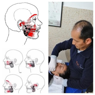 Fisiovital (Fisioterapia Y Rehabilitación)