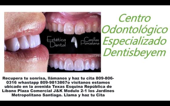 Qué son las carillas dentales y para qué sirven?  Las carillas dentales son reconstrucciones estéticas que se realizan en la parte externa (visible) de los dientes anteriores y que permiten modificar su color, forma y brillo.   Sus principales ventajas son su poder de adhesión, resistencia a la abrasión y gran sensación estética. Prácticamente no hay que reducir el diente para colocarlas. Una vez cementadas, el paciente puede comer con normalidad. Muchas personalidades de la vida pública y medios de comunicación hacen uso de esta técnica para conseguir una sonrisa atractiva.  Duración  Depende de los hábitos del paciente. Su duración media es de unos 12 años. En ocasiones, cuando el paciente sufre un impacto fuerte en la boca o muerde algo duro, alguna carilla puede fracturarse o descementarse. En caso de descementación, si la carilla está intacta, se vuelve a adherir. Si se ha roto, sencillamente se vuelve a hacer otra en pocos días. Mientras se confecciona la nueva carilla, se coloca otra carilla provisional de composite 