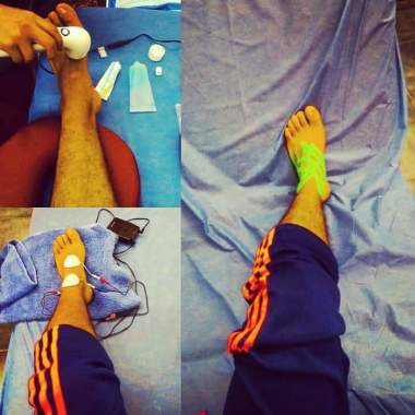 Rehabilitacion con agentes físicos, TENS, Electroterapia y Kinesio-Taping 
