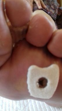 PROTECCIONES PARA HELOMAS CON NÚCLEO 