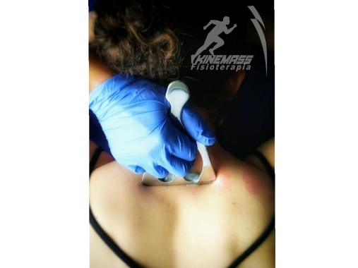 Liberación miofascial para cervicalgia.