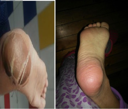 Paciente hospitalizada