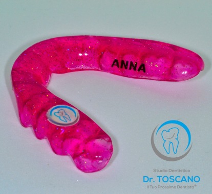 Bite con registrazione dell’articolazione per non fare più sentire dolore e personalizzati nei colori.