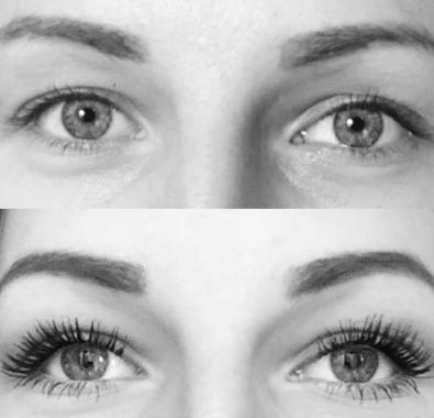 Réhaussement de cils
