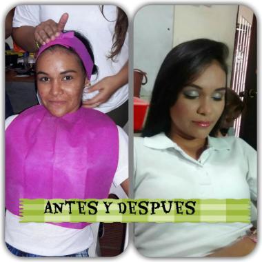 Perfeccionando un cutis lleno de acne