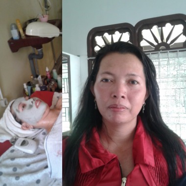 Pasien melakukan treatment facial setrika wajah galvanic spa nuskin menghilangkan flek hitam, kerutan dibadah dan meneruskan wajah dan pipi serta menghilangkan kantong mata, mengecilkan pori wajah dan membuat wajah cerah