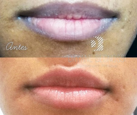 Micropigmentação labial com neutralização de cor 