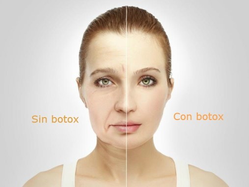 Botox