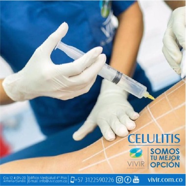 Anti Celulitis