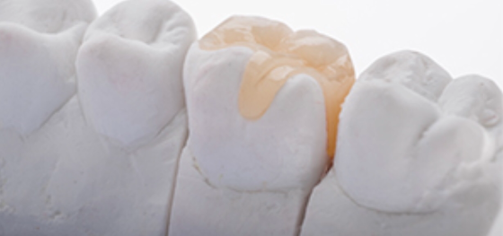 Porcelain filling 