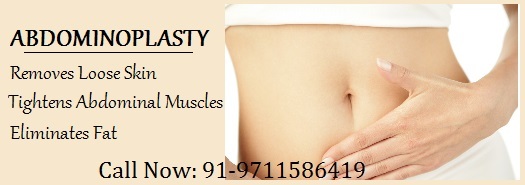 Tummy Tuck Abdominoplasty