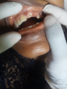 Before care of a cosmetic case