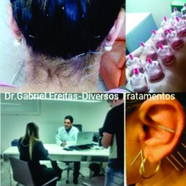 Acupuntura