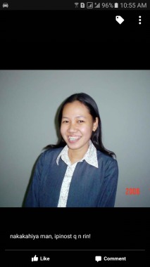 My patient during her orthodontic (bracea) treatment