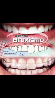 Tratamento de bruxismo.