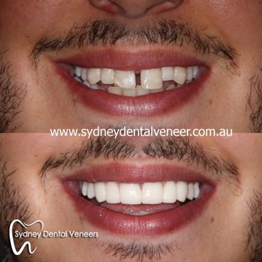 Sydney_orthodontics.jpg