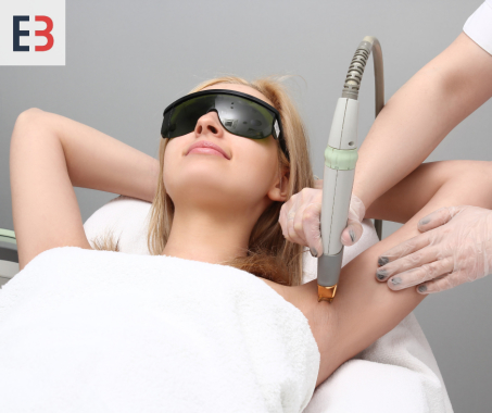 Laser hair removal