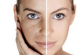 looking younger makes you feel better and confident!!