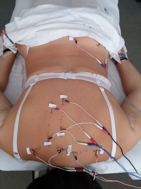 Electropuntura en contracturas
